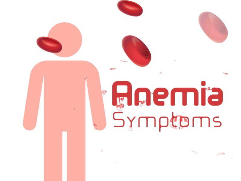 Anemia